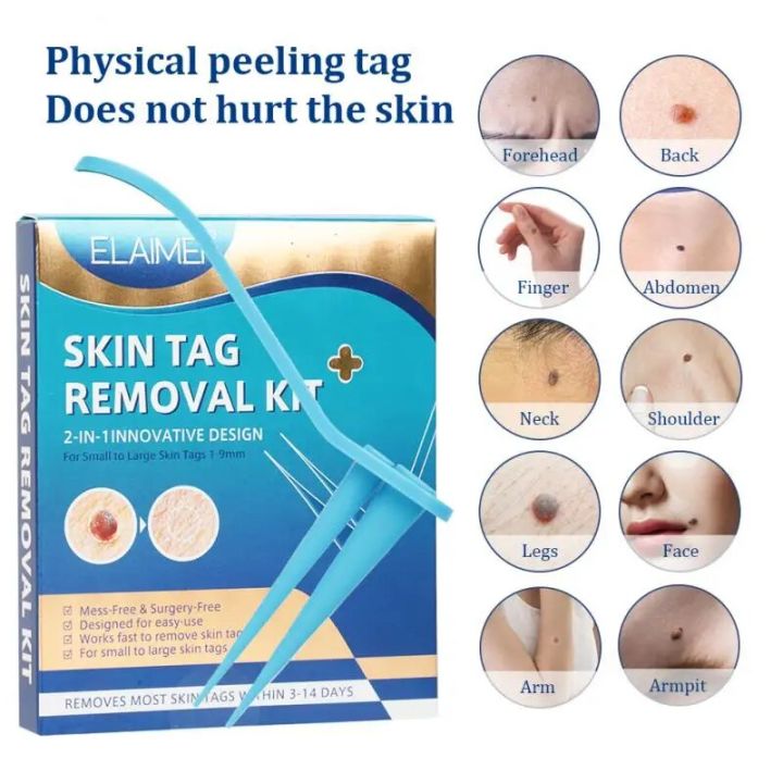 Auto%20Skin%20Tag%20Remover%20Double%20Head%20Wart%20Removal%20Pen%20Set%20Mole%20Warts%20Skin%20Blemishes%20Painless%20Cleaning%20Skin%20Care%20Tools%20Home%20Use%20-%20Image%202
