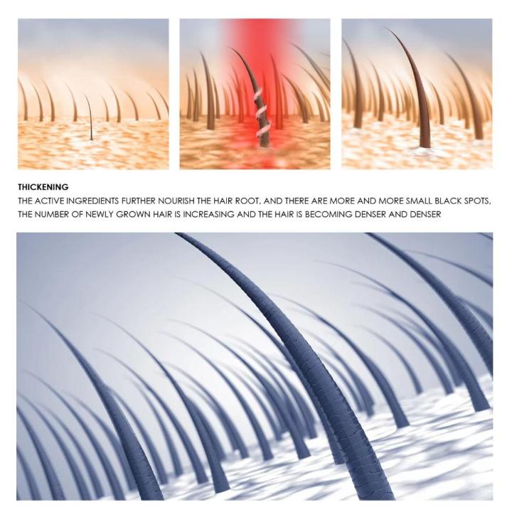 Men%20Beauty%20&%20Health%20Hair%20Growth%20Repair%20Damaged%20Hair%20Fermented%20Rice%20Water%20Serum%20Nourishing%20Hair%20Essential%20Oil%20-%20Image%204