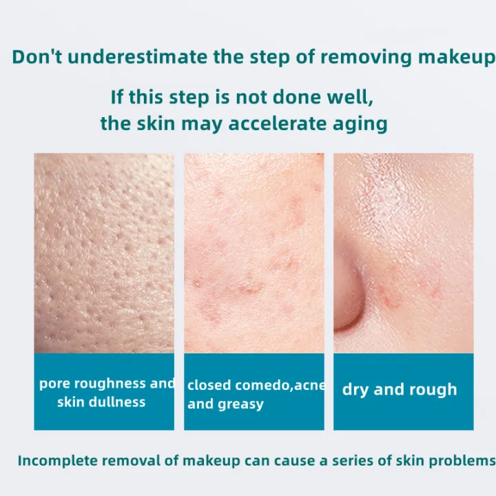 MYG%20USA%203in1%20Makeup%20remover%20oil%20150ml%20professional%20makeup%20remover%20moisturizing%20&%20nourishing%20skin%20-%20Image%203