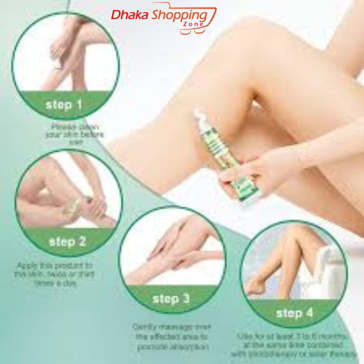 Vitiligo%20Treatment%20Cream%20Healthy%20White%20Spot%20Therapeutic%20Gel-Bath%20&%20Body%20Accessories%20-%20SL%20Discount%20Shop%20-%20Image%203