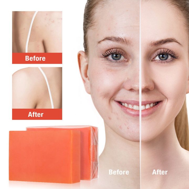 Kojic%20Acid%20Soap%20Skin%20Brightening%20Soap%20Natural%20Ingredients%20Soap%20Even%20Skin%20Tone%20-%20Image%202