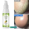 EELHOE Anti Crack Foot Hand Gel Ginger Cuticles Care Anti-Drying Healing Crack Frost Mask Dead Skin Removal Deep Moisturizing Feet Crack Whitening Smooth Feet Care.