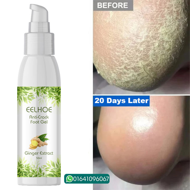EELHOE%20Anti%20Crack%20Foot%20Hand%20Gel%20Ginger%20%20Cuticles%20Care%20Anti-Drying%20Healing%20Crack%20Frost%20Mask%20Dead%20Skin%20Removal%20Deep%20Moisturizing%20Feet%20Crack%20Whitening%20Smooth%20Feet%20Care%20-%20Image%202