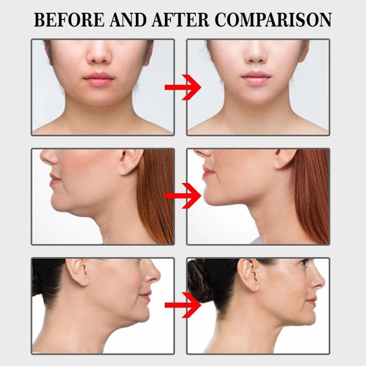 100pcs%20Face%20Neck%20Lifting%20Stickers%20Breathable%20Waterproof%20V%20Face%20Anti%20Wrinkle%20Chin%20Lift%20Patch%20Skin%20Care%20Invisible%20Adhesive%20Tape%20Vnce%20Lncei%20-%20Image%206