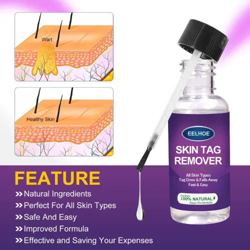 Skin%20Tag%20Remover%20Wart%20Remover%20Skin%20Tag%20Removal%20Quickly%20and%20Easily%20Remove%20Common%20Skin%20Tag%20Wart%20and%20Callus%20Effective%20and%20Scarless%20Suitable%20for%20All%20Skin%20Types%20Deep%20Care-Magic%20Gift%20Store%20-%20Image%205