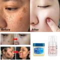2Pcs Remove Black Skin Face Cream Vaseline Vitamin E Cream Set Whitening Moisturizing Nourishing Repair Cream Women Skin Care. 