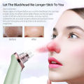 CkeyiN  Facial Cleaning 5 Tips Blackhead Remover Electric Vacuum Suction Blackhead Acne Extractor Pores Deeply Cleaning Tool Multifunctional Skin Care Beauty Device MR278G. 