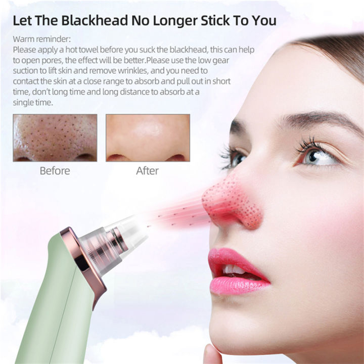 CkeyiN  Facial Cleaning 5 Tips Blackhead Remover Electric Vacuum Suction Blackhead Acne Extractor Pores Deeply Cleaning Tool Multifunctional Skin Care Beauty Device MR278G