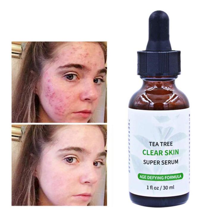 MELAO TEA TREE CLEAR SKIN SUPER SERUM30ml