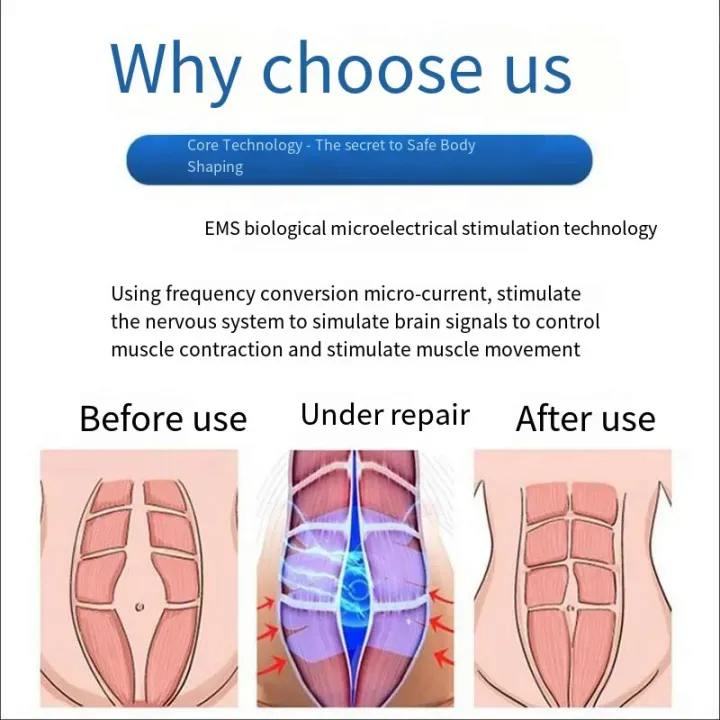 Biofeedback%20EMG%20Pelvic%20Muscle%20Electrical%20Trainer%20Kegel%20Exerciser%20Incontinence%20Therapy%20For%20Women%20-%20Image%205
