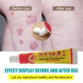 2pcs Natural Psoriasis Ointment Tinea Pedis Antibacterial Antipruritic Dressing Treat Dermatitis Eczema Skin Repair Care Cream. 