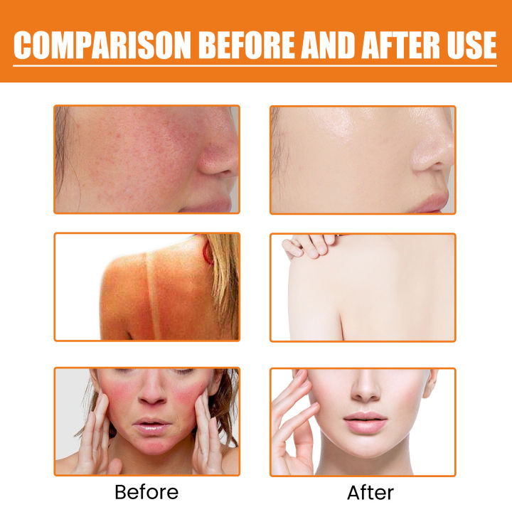 EELHOE%20Sunscreen%20Lotion%20Solar%20Protector%20Cream%20Oil%20Control%20Sunscreen%20Waterproof%20Refreshing%20Sun%20Protective%20Cream%20Body%20Sunblock%2050g%20-%20Image%203