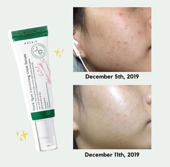 AXIS-Y%20Dark%20Spot%20Correcting%20Glow%20Serum%2050ml%20-%20Image%202