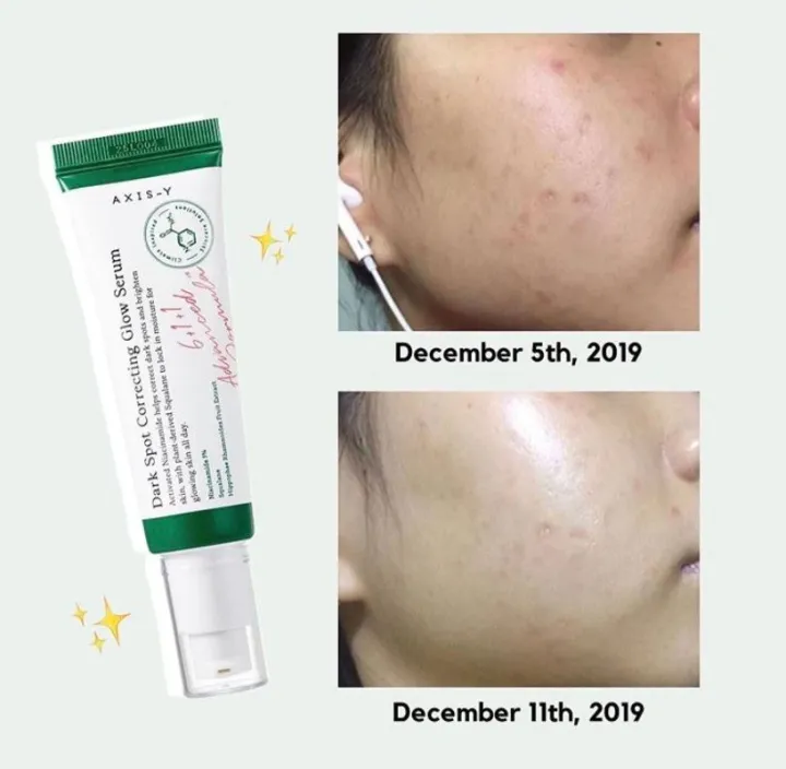 AXIS-Y%20Dark%20Spot%20Correcting%20Glow%20Serum%2050ml%20-%20Image%202