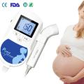 Medical Doppler Fetal Ultrasound Baby Heartbeat Home Detector Pregnant Smart Big Screen Baby Heart Rate Monitor Pocket Monitor. 