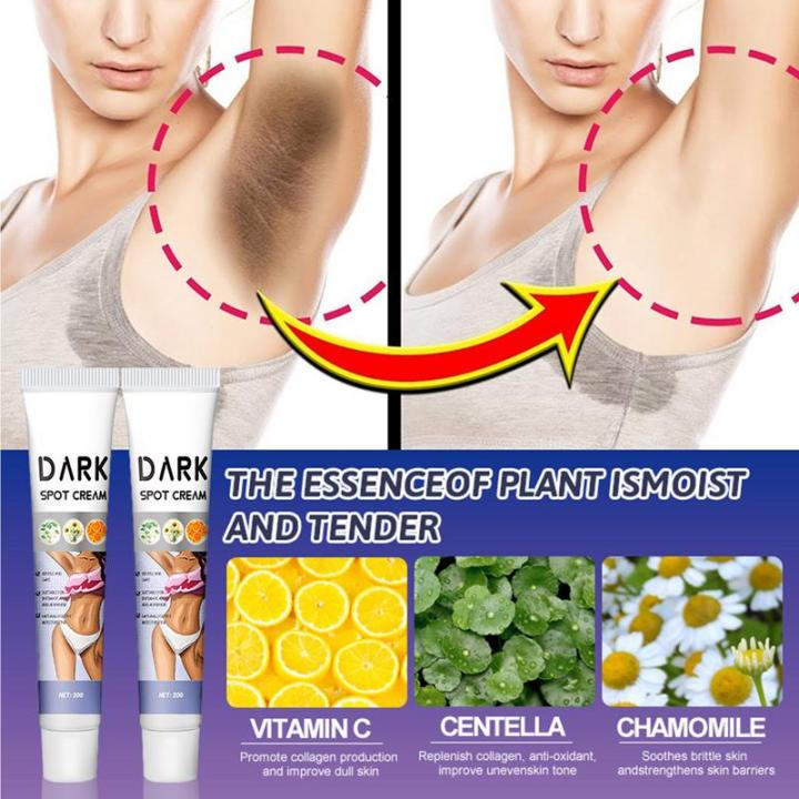 Inner%20Thigh%20Lightening%20Cream%20Black%20Spot%20Remover%20for%20Inner%20Thighs%20and%20Armpits%20Intimate%20Area%20Black%20Armpit%20and%20Spot%20Remover%2020g%20-%20Image%205