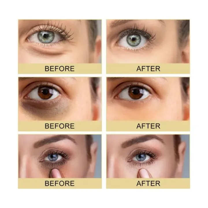 GreenTea/Roselle%20Tea%20Hydrogel%20Eye%20Mask%20Gel%20Eye%20Patch%20Anti-aging%20Wrinkles%20Brightening%20Soothing%20Calming%20Korean%20Skin%20Care%20Products%20Abandon%20Abandon%20-%20Image%203