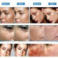 Chinese Astragalus Whitening Freckles Cream Remove Melasma Fade Dark Spots Dark Yellow Skin Brighten Anti-aging Face Skin Care. 