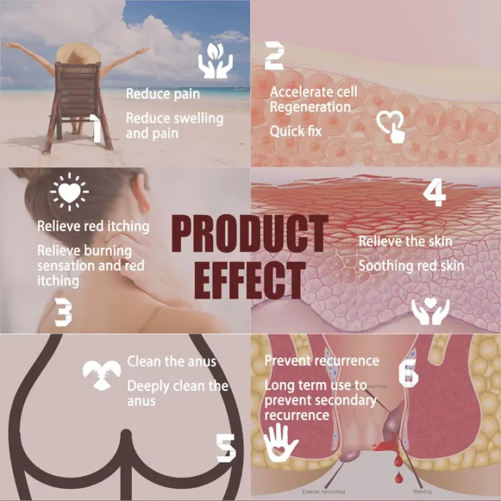 Hemorrhoid%20Relief%20Cream%20External%20Anal%20Fissure%20Therapy%20Internal%20Swell%20Bleed%20Treatment%20Anti%20Meatball%20Anal%20Itching%20Herbal%20Ointment%20-%20Image%206