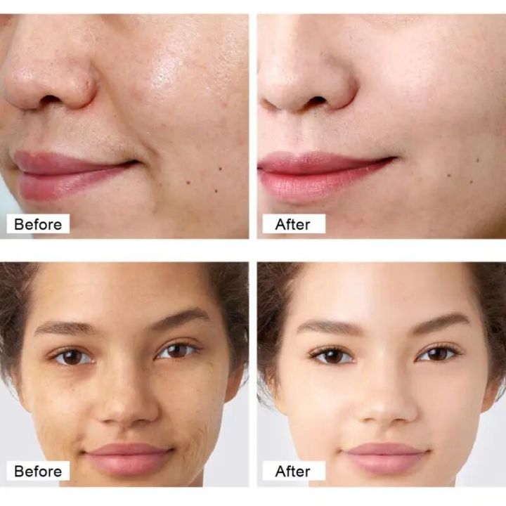 Retinol%20Face%20Cream+Facial%20Serum+Eye%20Cream%20Set%20Anti-Aging%20Remove%20Wrinkle%20Eye%20Bag%20Whitening%20Moisturizing%20Skin%20Lightening%20Cream%20-%20Image%203