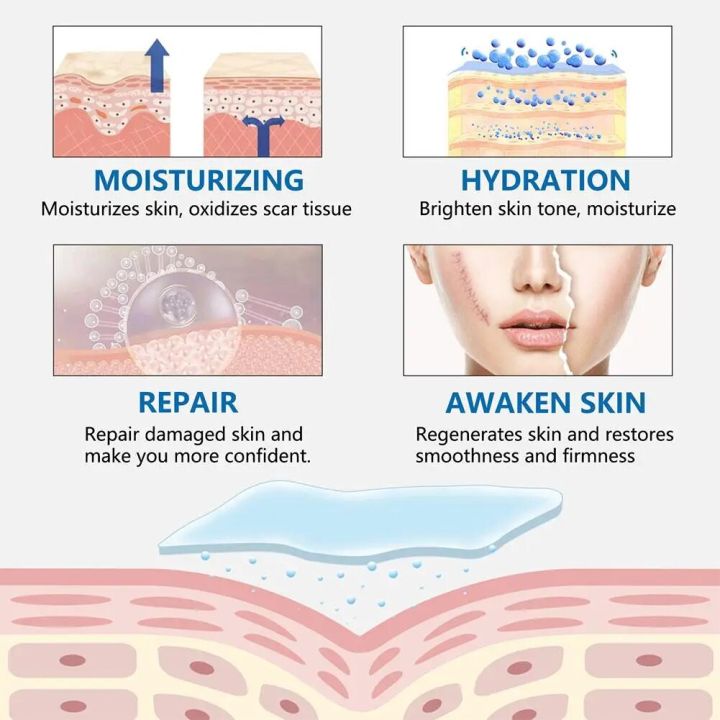 Efficient%20Silicone%20Scar%20Removal%20Gel%20Tape%20For%20Surgery%20Scar%20Repair%20Sticker%20Sheet%20Therapy%20Patch%20Waterproof%20Skin%20Care%20Patches%20-%20Image%204