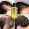 Unisex Anti Hair Loss Ginger Shampoo Hair Growth Products Shampoo Against Hair Loss Mild Treatment Ginger Shampoo For Hair Loss. 