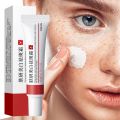 Face Dark Spots Remover for Women Remove Melasma Freckles Cream Removal Melanin Whitening Cream Fade Spots Skin Brightening Care.