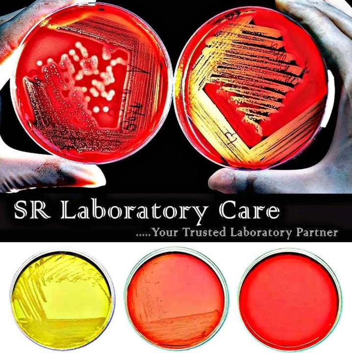 Yeast%20/%20Yeast%20Granulated%20Powder%20/%20Merck-Germany%20/%20For%20Laboratory,%20Food,%20Biofloc,%20Others%20Fish%20Firming%20&%20Other%20Uses%20/%20250gm%20-%20Image%204