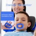 Blue New 1Pc Dental Retractor Soft Silicon Intraoral Lip Cheek Retractor Mouth Opener Cheek Expand Dental Orthodontic. 