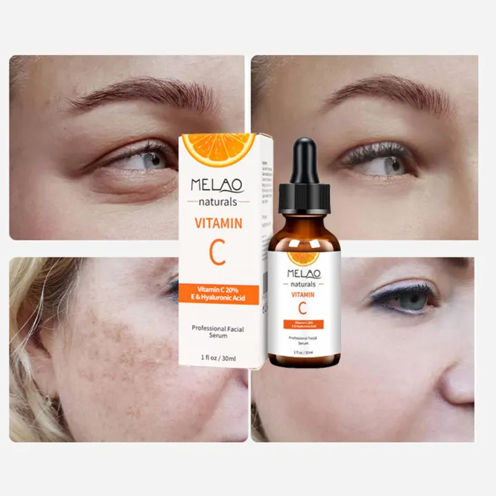 MELAO%20private%20label%20anti%20wrinkle%20Vitamin%20C%20Serum%20-%20Image%202