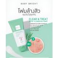 Clear & Treat Acne Cleansing Foam 120g Baby Bright. 