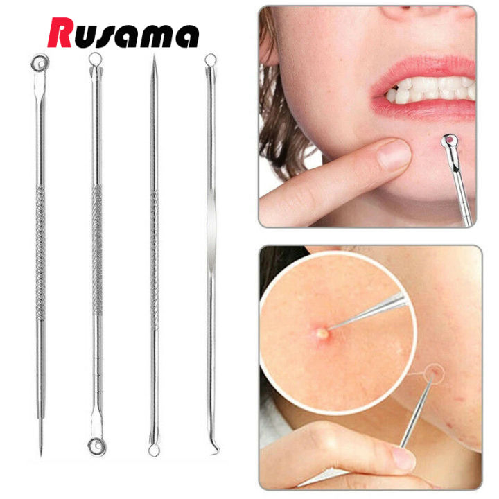 Professional%20Pimple%20Popper%20Tool%20Kit%20skin%20care%20product%20%20-%20With%20Comedone%20Extractor%20Milia%20Removal%20Tool%20Blackhead%20Tweezers%20and%20Whitehead%20Remover%20Tool%20Spot%20Treatment%20Acne%20Set%20-%20Derma%20Roller%20-%20Image%202