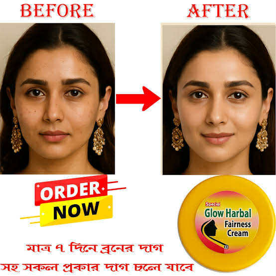 Glow%20Herbal%20Fairness%20cream%20-%20Image%203