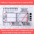 NCANRUI 2pc ECG 7 Step Ruler,ECG 7 Step Ruler for ECG/EKG Interpretation, ECG Reference Guide Ruler,EKG Calipers Measuring Tool.