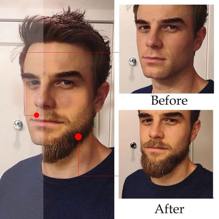 Beard%20Growth%20Essential%20Oil%20Natural%20Effective%20Thicken%20More%20Beard%20Nourishing%20Growth%20Oil%20For%20Men%20Beard%20Care%20Hair%20Growth%20products%20-%20Image%204