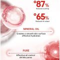 Fast Scar Removal Cream Effective Treatment Stretch Marks Burn Surgical Scars Acne Spots Repair Whitening Moisturizing Skin Care.