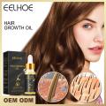 EELHOE Hair Growth Oil-20ml. 