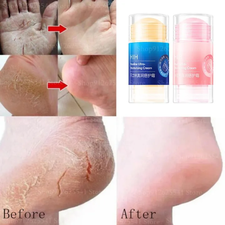 2Pcs%20Anti-Dry%20Cracked%20Foot%20Hand%20Cream%20Vaseline%20Moisturizing%20Cream%20Smooth%20Wrinkle%20Multi%20Balm%20Stick%20Removal%20Dead%20Skin%20Feet%20Care%20-%20Image%202
