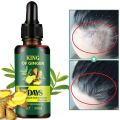 30ml Ginger Hair Care Essential Oil 7 Day Improves Scalp Environment Hair Loss Treatment Hair Growth Care Essence Oil.