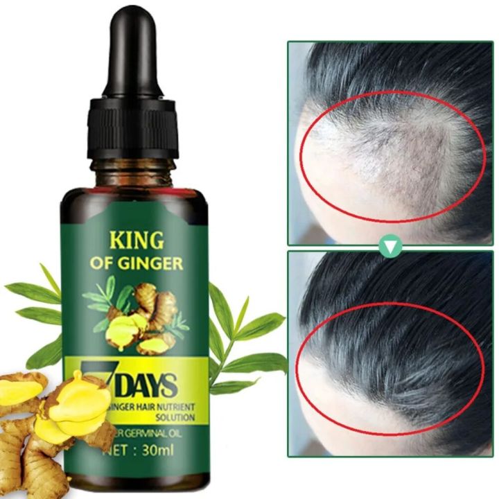 30ml Ginger Hair Care Essential Oil 7 Day Improves Scalp Environment Hair Loss Treatment Hair Growth Care Essence Oil