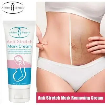 Aichun%20Beauty%20Anti%20Stretch%20Mark%20Cream%2060gm%20Intensive%20Skin%20Treatment%20for%20Improvement%20&%20Elimination%20-%20Image%205