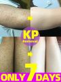 7-Day Fast Body Scrub Cream Moisturizing Skin Repair Keratosis Pilaris Removing Strawberry Legs Eraser Nourishing Body Skin Care. 