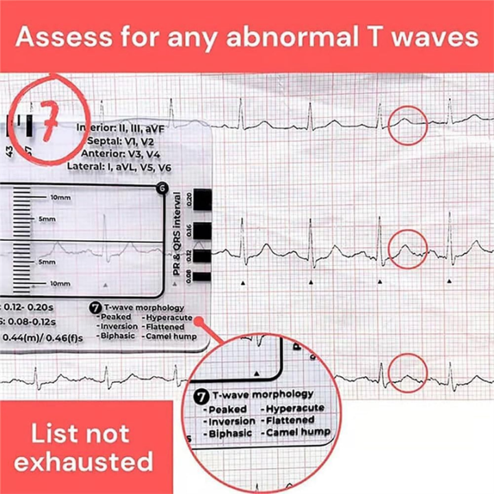 NCANRUI%202pc%20ECG%207%20Step%20Ruler,ECG%207%20Step%20Ruler%20for%20ECG/EKG%20Interpretation,%20ECG%20Reference%20Guide%20Ruler,EKG%20Calipers%20Measuring%20Tool%20-%20Image%202