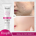 RtopR Face Exfoliating gel Moisturizer Repair Facial Scrub Cleaner Acne Blackhead Treatment Face Cream skin care. 