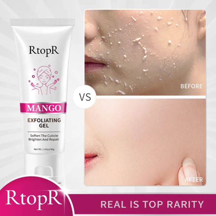 RtopR%20Face%20Exfoliating%20gel%20Moisturizer%20Repair%20Facial%20Scrub%20Cleaner%20Acne%20Blackhead%20Treatment%20Face%20Cream%20skin%20care%20-%20Image%203