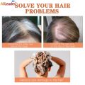 Synthetic 10'' Mini Wig Invisible Seamless False Bangs Hairpieces Natural Hair Bangs Overhead Clip In Wiglets Cover Gray Hair.