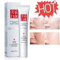 Whitening Cream For Face Spots Remove Dark Spot Melasma Anti-Pigmentation Improve Dullness Brighten Face Skin Care Cream. 