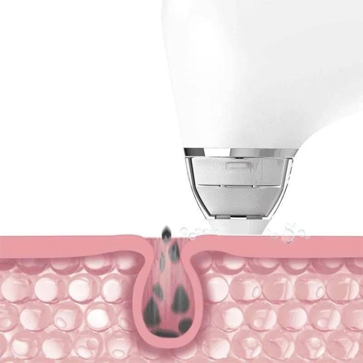 DOCO%20Ultra-micro%20Bubble%20Pore%20Vacuum%20Cleaner%20Blackhead%20Remover%20-%20Image%204