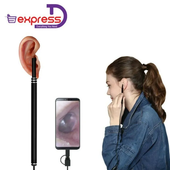 USB%20Otoscope-Ear%20Endoscope%20Diameter%20Visu%20Waterproof%20HD%20Ear%20Camera%20with%20Ear%20Tool%20and%206%20Adjustable%20LED%20Lights%20for%20-Android%20and%20Windows%20-%20Image%206