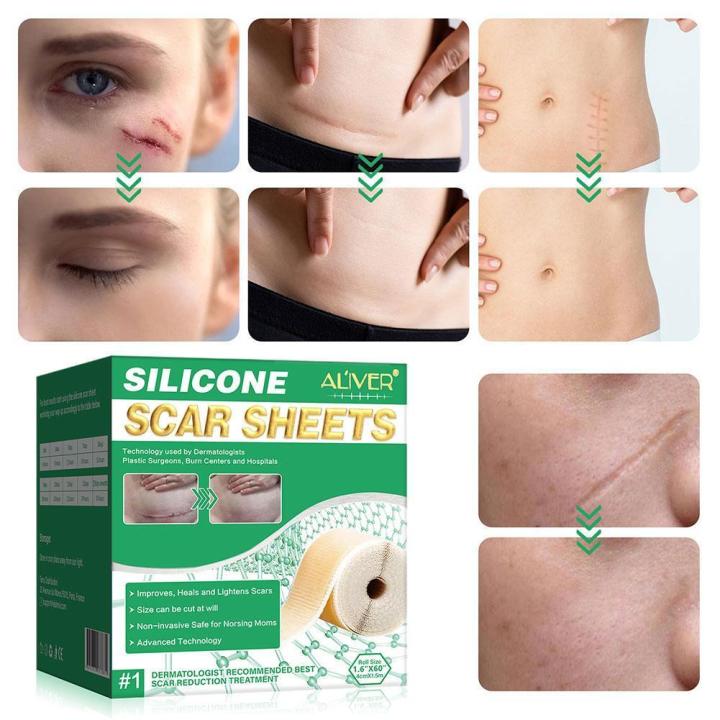 Silicone Scar Sheets Patch Painless Scar Repair Tape Roll Effective Scar Removal Strips For C-Section Keloid Surgery Burn A H8K5